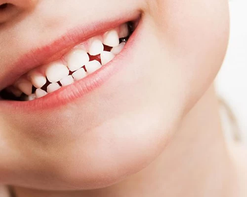 Baby teeth Alsundos Dental Complex